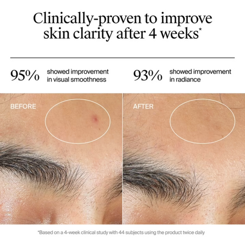 Neutrogena Evenly Clear Acne Gel Moisturizer, 1.7 fl. oz
